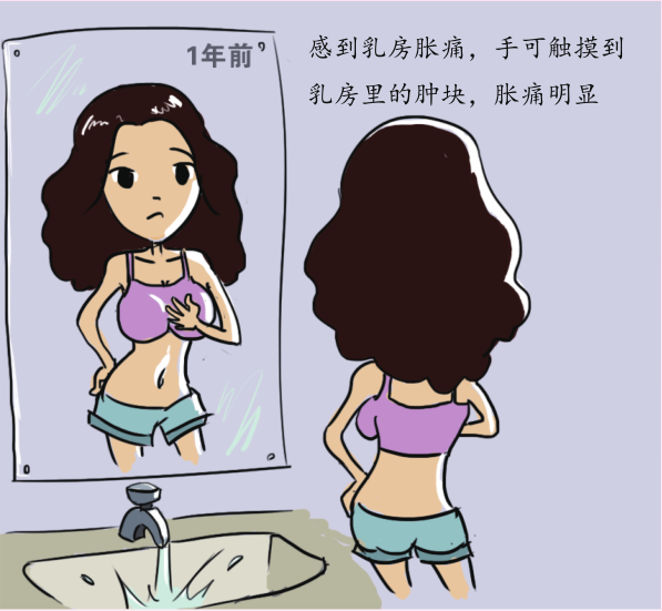 乳腺增生要早发现早治疗