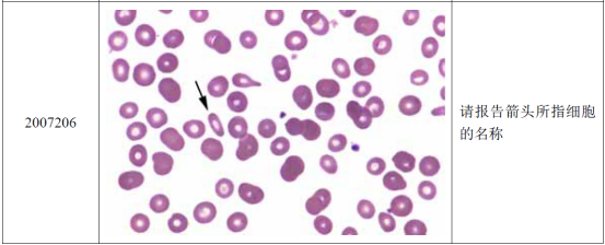 (2)2007年第2次血细胞形态学室间质量评价