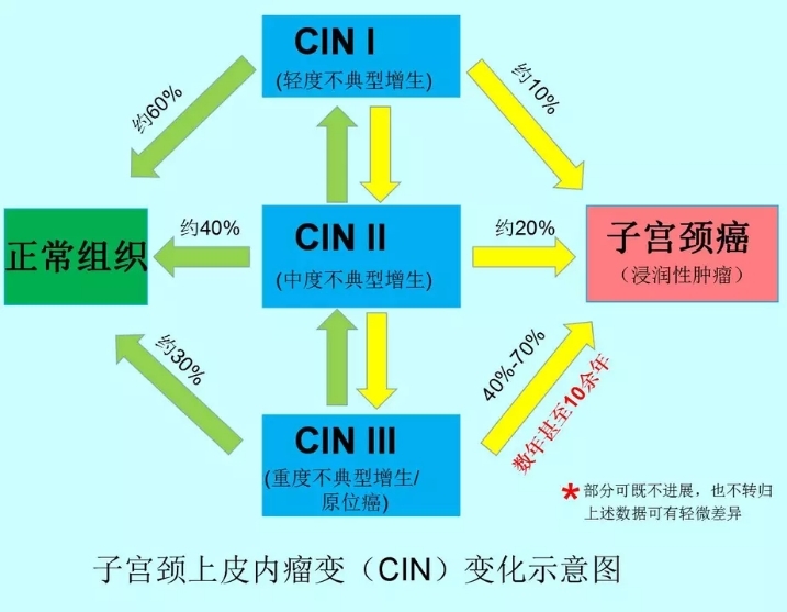 宫颈癌的演变过程